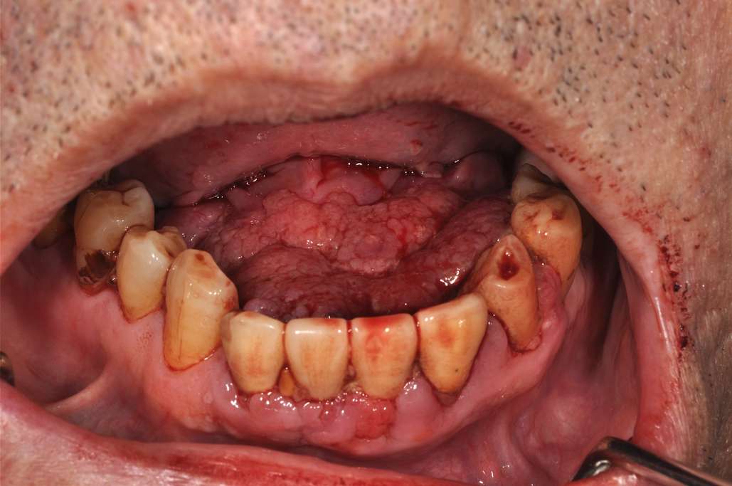 生検の準備のために何をする必要がありますか?